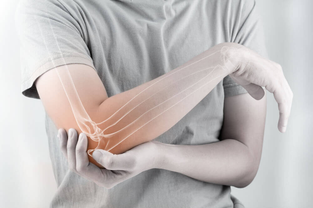 A person with elbow joint pain